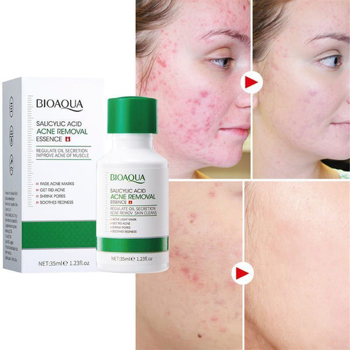 قطره سالیسیک اسید BIOAQUA